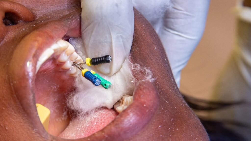 Root Canal vs Tooth Extraction: Which Option Is Right for You? Root Canal vs Tooth Extraction: Which Option Is Right for You?